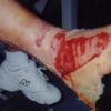 Pop goes The blister 2002